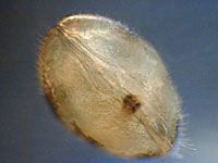 Ostracod picture